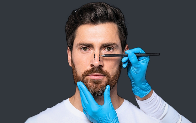 rhinoplasty (commonly known as a nose job) 
